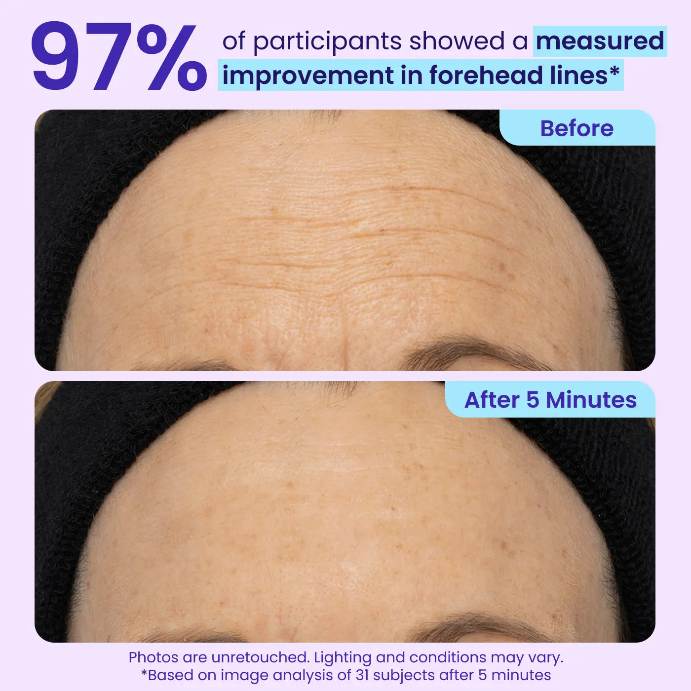 Final 3 Hours: 60%OFFđ„ Instant Lift Eye Gel for Puffiness, Bags & Dark Circles-HS